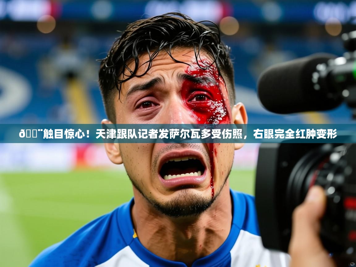 2025华体会登录手机版最新😨触目惊心！天津跟队记者发萨尔瓦多受伤照，右眼完全红肿变形  第1张