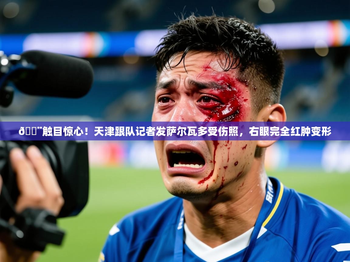 2025华体会登录手机版最新😨触目惊心！天津跟队记者发萨尔瓦多受伤照，右眼完全红肿变形  第2张